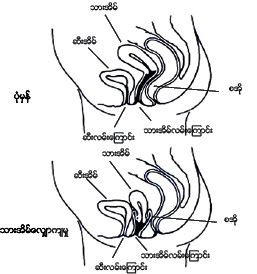 Pelvic Floor Muscle