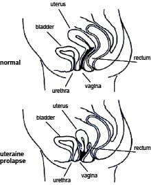 Pelvic Floor Muscle