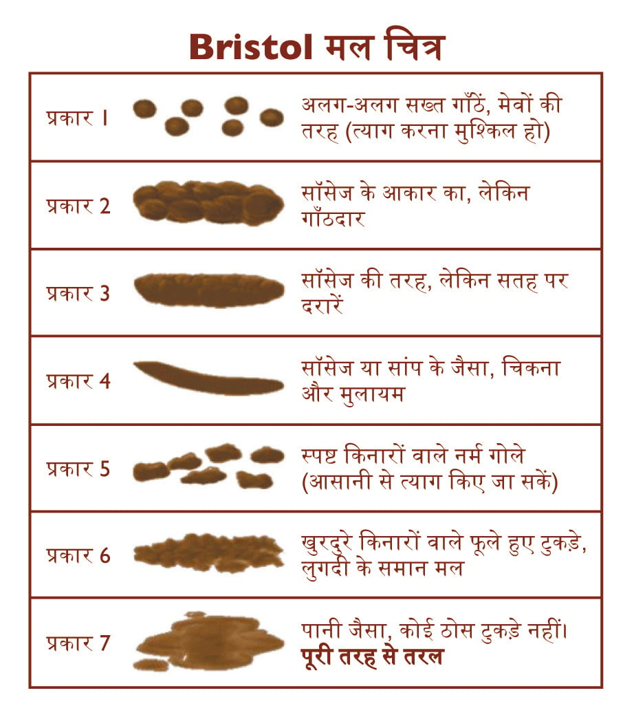 Bristol Stool Chart