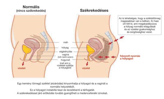 Prostatitis és belek)