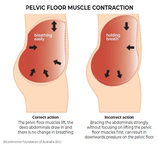 Pelvic Floor Muscle Contraction