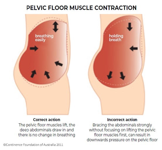 Pelvic Floor Muscle Training in Men - Correct Technique